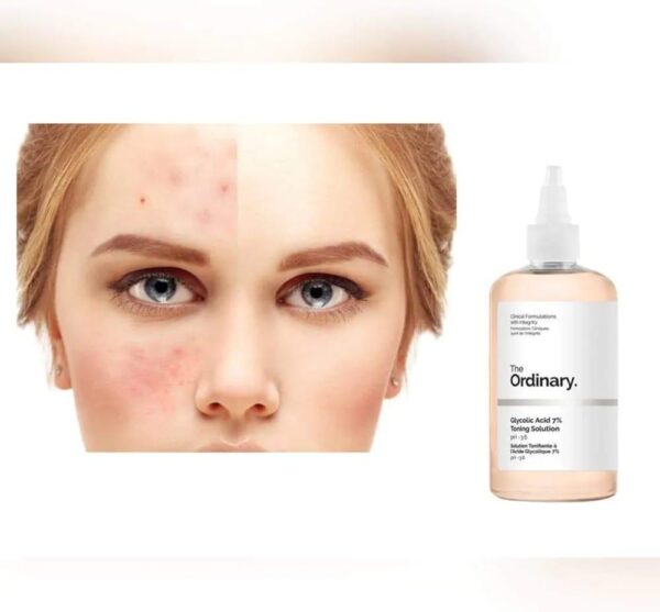 Golden Face Toner - Exfoliating & Brightening Formula | 240ml